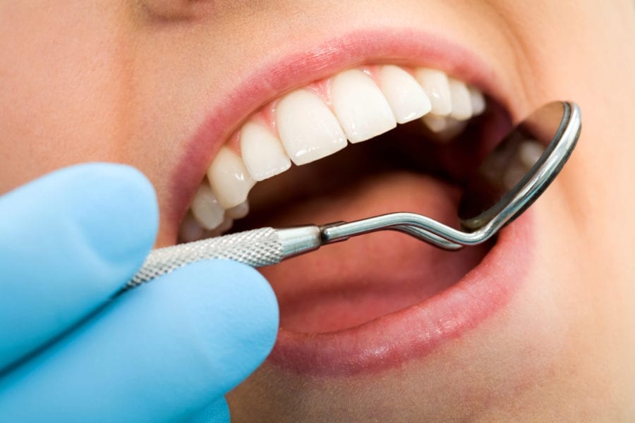How Can I Prevent Cavities? Dentist in Columbus, GA