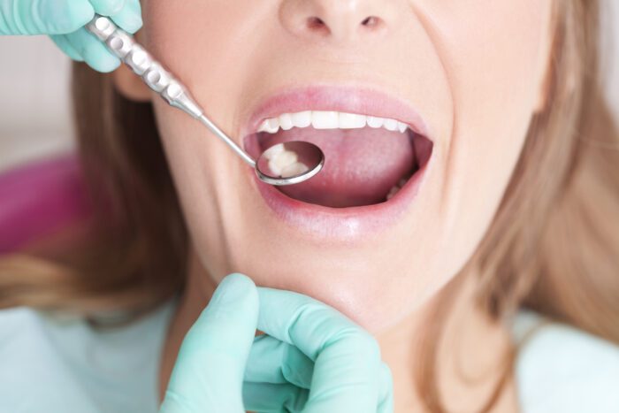 Why Are Dental Visits Important?