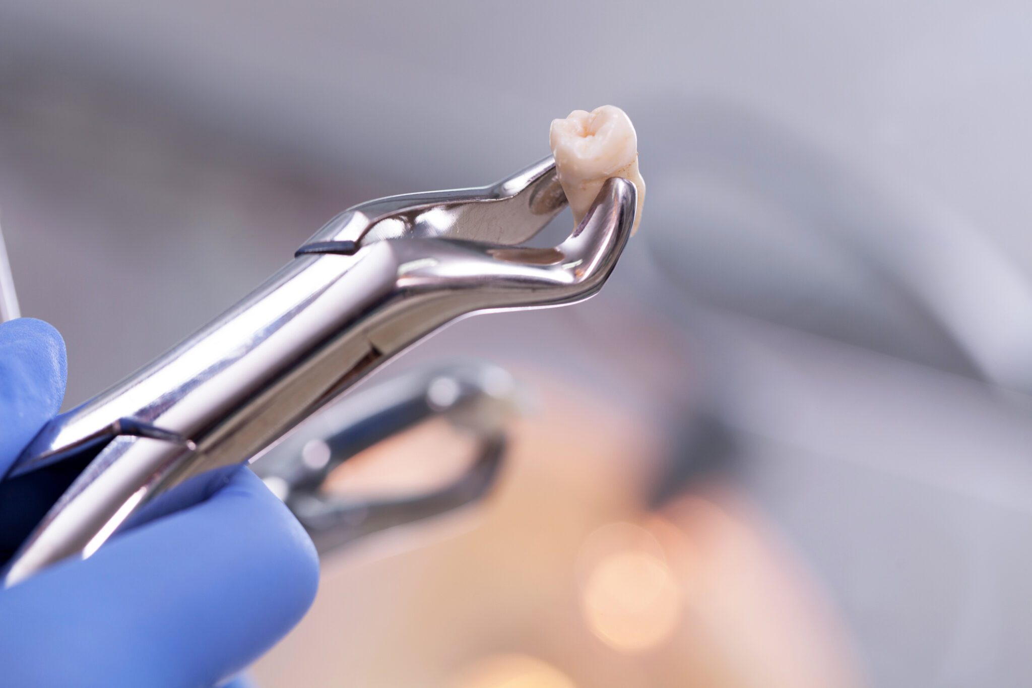 Tooth Extraction in Columbus ,GA, can seem scary, but it's a crucial treatment option